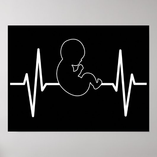Poster Bébé Pro-Vie poulse pulse EKG : foi chrétienne (Devant)