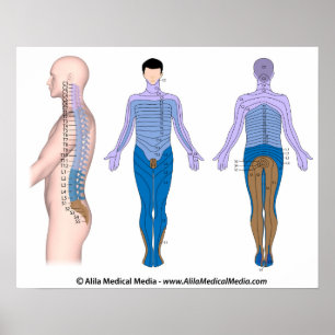 Poster Blessures à la moelle épinière, dessin médical.