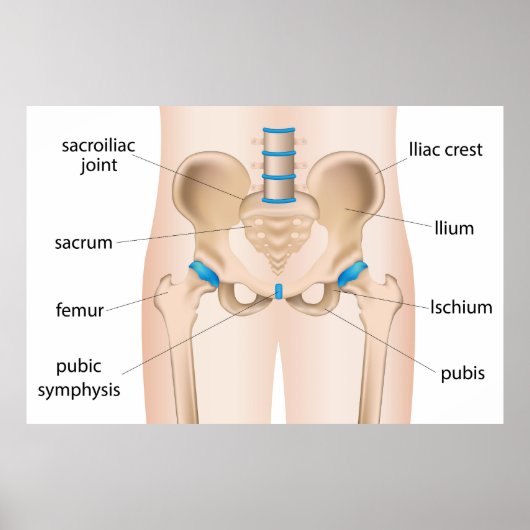 Poster Brûlée de douleur de la hanche (Devant)