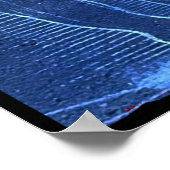 POSTER CANCER DU SEIN (Coin)