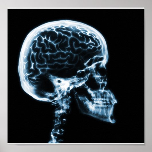 POSTER CERVEAU JUMEAU X-RAY - BLEU (Devant)