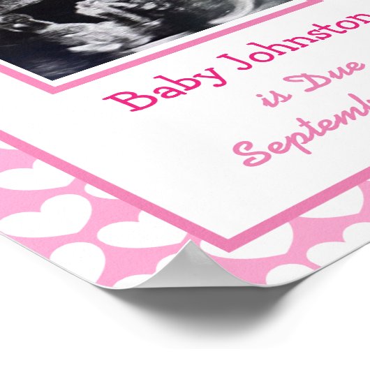 Poster C'est une fille, Grossesse Faire-part Ultrasound P (Coin)