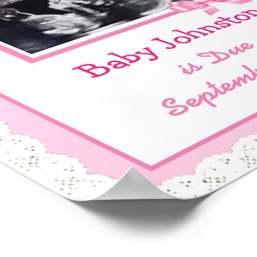 Poster C'est une fille, Grossesse Faire-part Ultrasound P (Coin)