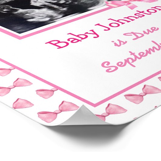 Poster C'est une fille, Grossesse Faire-part Ultrasound P (Coin)