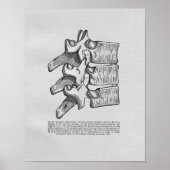 Poster Chiropractic Subluxation Vintage Print (Devant)