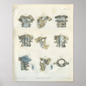 Poster Chiropratique de l'anatomie supérieure cervicale e (Devant)