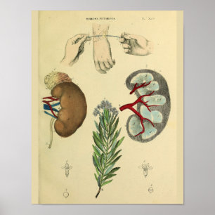 Poster Chirurgie au poignet Médicale Reins Anatomie Art I