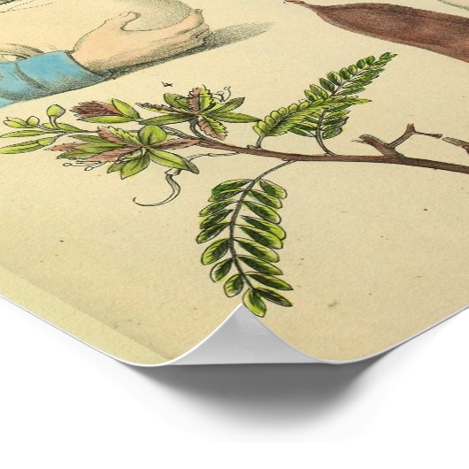 Poster Chirurgie cérébrale Tête Anatomie Art Docteur Impr (Coin)