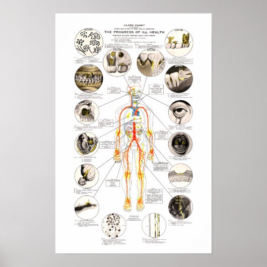 Poster Clark Dental Health Chart pour dentiste (Devant)