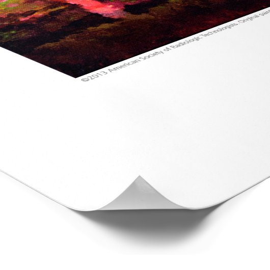 Poster Couverture à rayons X - Renal Cherry Tree par L. R (Coin)