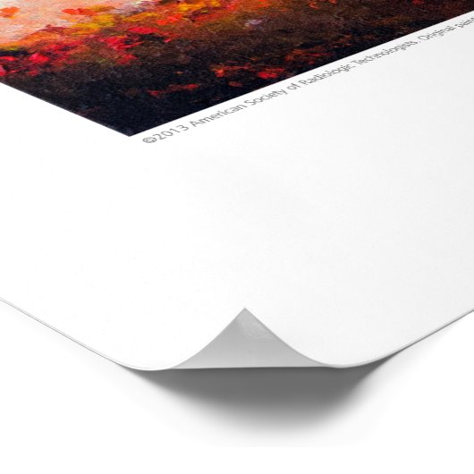 Poster Couverture X-ray - Cérébrale Stormy par L. Rainey (Coin)