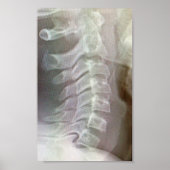 Poster Cravate cervicale (Devant)