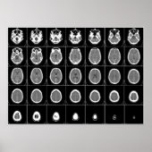 POSTER CT SCAN DE TÊTE (Devant)