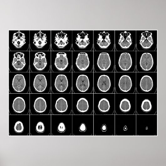 POSTER CT SCAN DE TÊTE (Devant)
