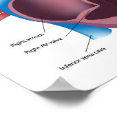 Poster d'anatomie du coeur humain (Coin)