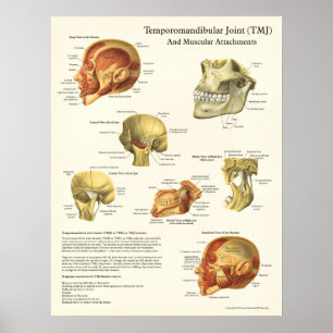 Poster d'anatomie et d'attachement musculaire TMJ