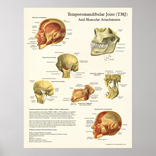 Poster d'anatomie et d'attachement musculaire TMJ (Devant)
