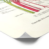 Poster d'anatomie Lumbosacral et dégénérescence de (Coin)