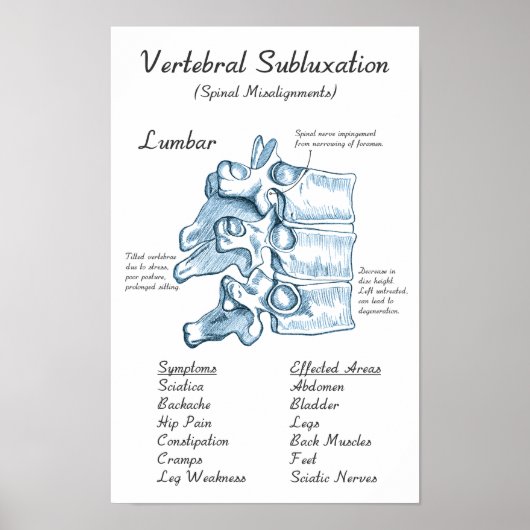 Poster d'art de Lumbar Subluxation Chiropratique (Devant)