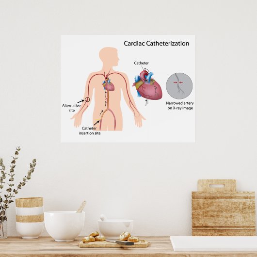 Poster de cathétérisation cardiaque (Cuisine)