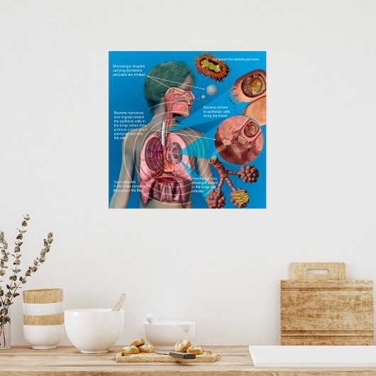 Poster de la coqueluche (Cuisine)