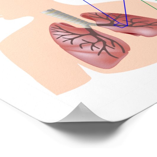 Poster de la maladie pulmonaire (MPOC) (Coin)