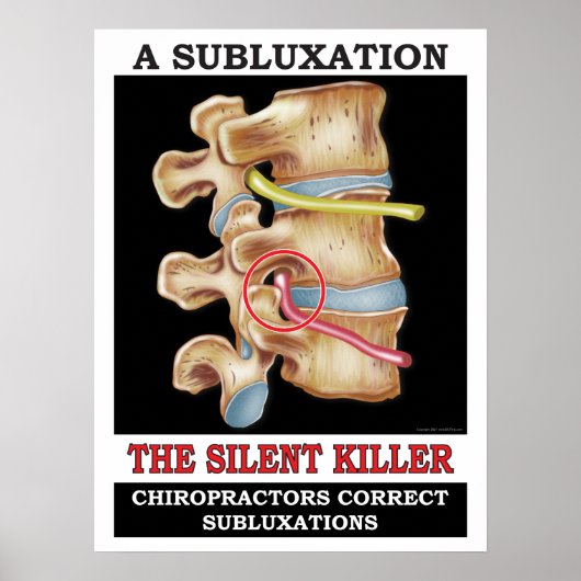Poster de subbluxation Vertébrale Chiropratique (Devant)