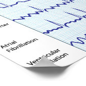 Poster d'ecg normal et pathologique (Coin)