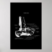Poster Décor Orthopédique Anatomie Conjointe (Devant)