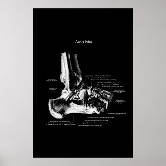 Poster Décor Orthopédique Anatomie Conjointe (Devant)