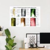Poster Dégénérescence de la colonne lombaire Chiropratiqu (Bureau à domicile)