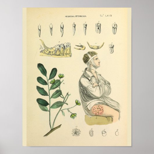 Poster Dental Teeth Jaw Anatomie Vintage Art Imprimer (Devant)