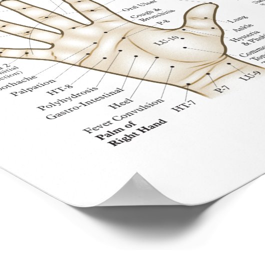 Poster des points de microsystème Acupuncture (Coin)