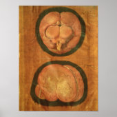 Poster Dessin anatomique du cerveau humain (Devant)