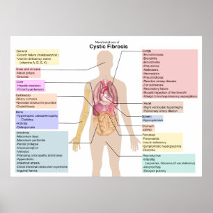 Poster Diagram of the Manifestations of Cystic Fibrosis