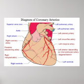 Poster Diagramme des artères coronaires d'un coeur humain (Devant)