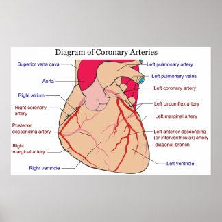 Poster Diagramme des artères coronaires d'un coeur humain