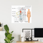 Poster Diagramme d'un traitement Médicale d'hémodialyse (Bureau à domicile)