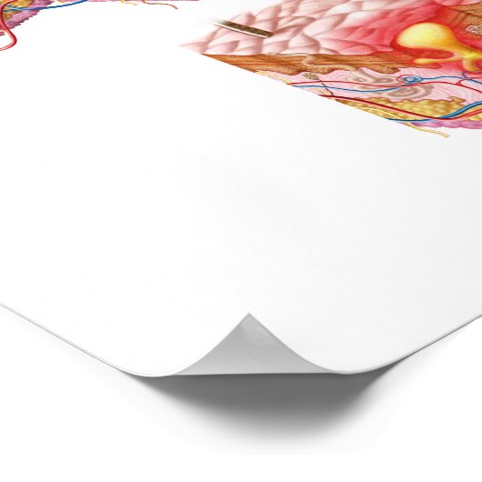 Poster Différents Types D'Acné (Coin)