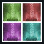 Poster du Carré numérique X-Ray Pop Art<br><div class="desc">Le design comprend quatre versions colorées différentes d'un numériquement de rayons X lumbopelvic ap amélioré et embelli.</div>