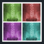 Poster du Carré numérique X-Ray Pop Art<br><div class="desc">Le design comprend quatre versions colorées différentes d'un numériquement de rayons X lumbopelvic ap amélioré et embelli.</div>