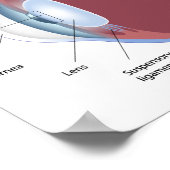 Poster du détachement rétinien des yeux (Coin)