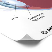 Poster du détachement rétinien des yeux (Coin)