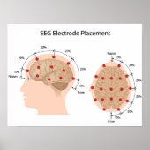 Poster du diagramme de placement d'électrode EEG (Devant)
