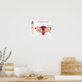 Poster du système de reproduction féminin (Cuisine)
