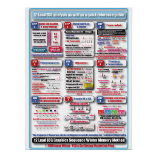 POSTER ECG-training Perfect Poster