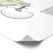 Poster Effets de la subbluxation de la colonne vertébrale (Coin)