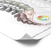 Poster Effets de la subbluxe spinale en français (Coin)