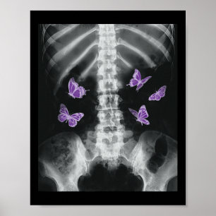 Poster Egirl Xray Squelette rose Papillon Harajuku Y2k Da