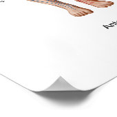 Poster Embolisme Pulmonaire, Voie D'Embolus (Coin)